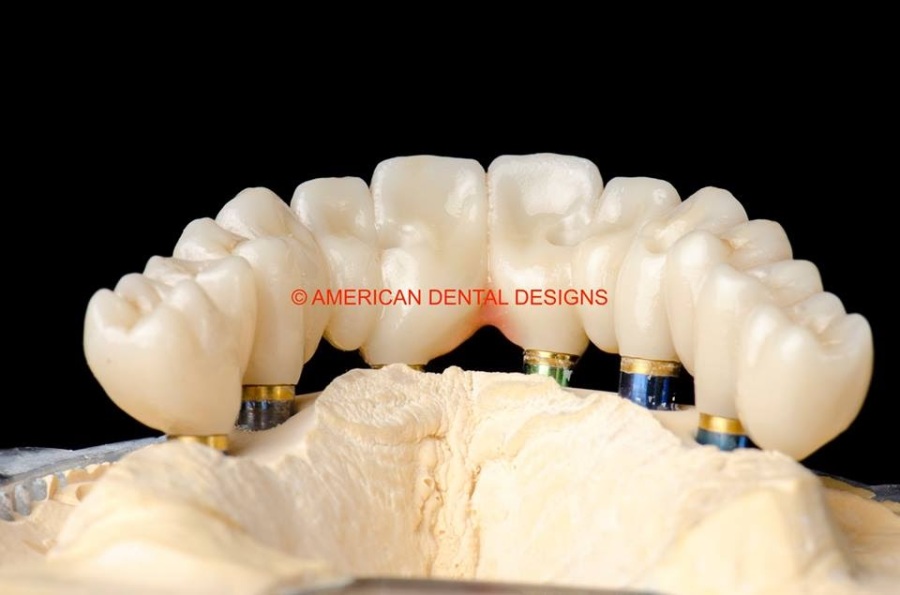 America-Dental-Design